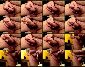 injections