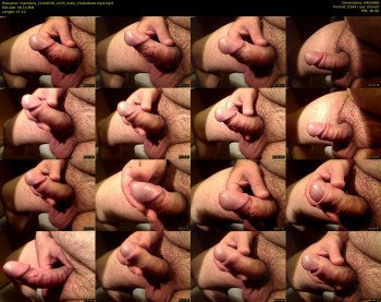 injections